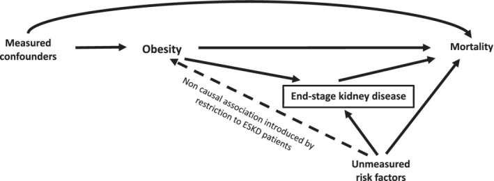 Diagram showing collider stratification bias in causal inference