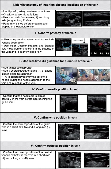 Six-step approach to ultrasound-guided central venous catheter placement showing probe positioning, vessel identification, needle guidance, wire confirmation, and catheter insertion