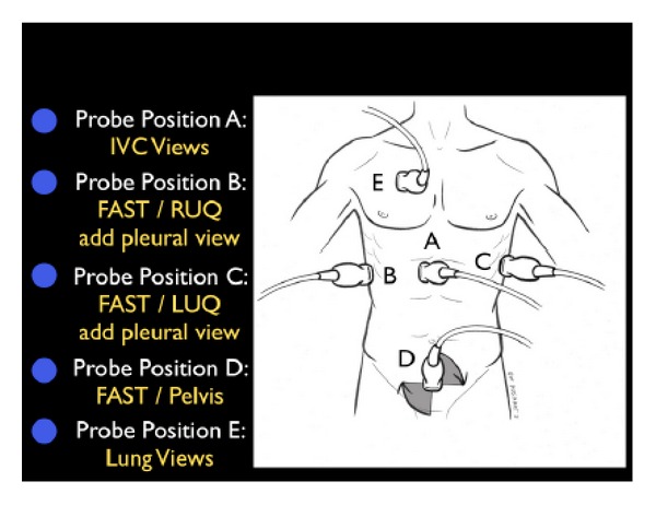 RUSH protocol tank evaluation showing IVC assessment, lung ultrasound for B-lines, and FAST exam views
