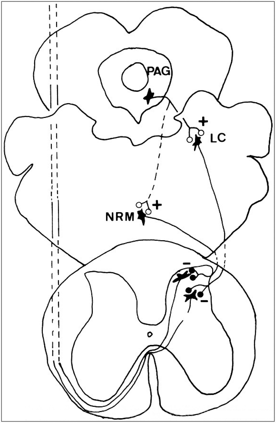Descending analgesia systems showing nucleus raphe magnus and locus coeruleus projections