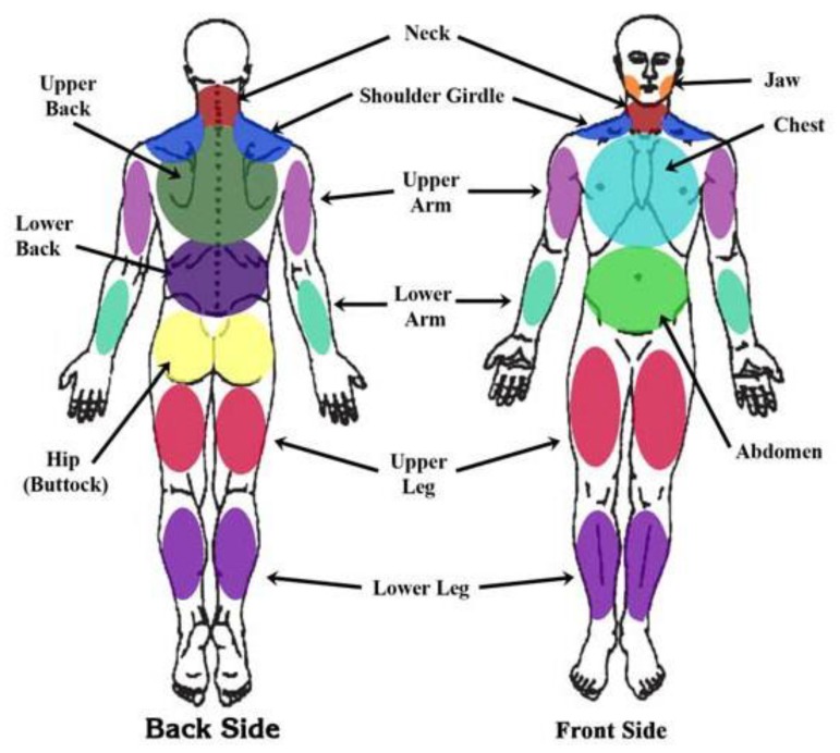 Widespread Pain Index body areas used in 2010 ACR fibromyalgia diagnostic criteria