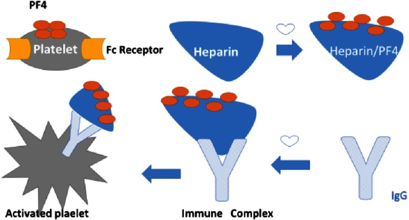 Pathophysiology of heparin-induced thrombocytopenia showing antibody formation against PF4-heparin complexes and platelet activation