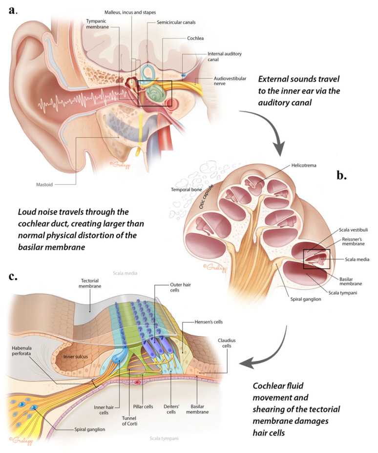 Diagram of inner ear anatomy showing cochlear structures vulnerable to noise damage