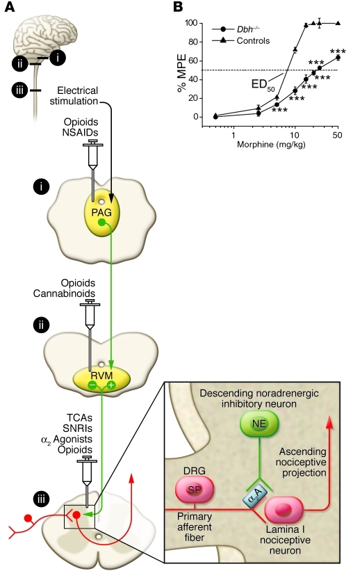 Descending inhibitory pathways and analgesic drug targets including PAG, NRM, and dorsal horn