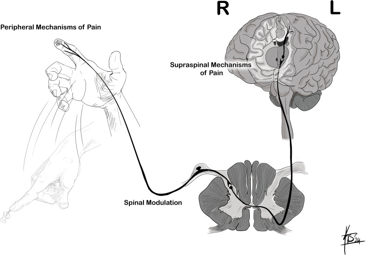 Route of pain transmission from peripheral nociceptors through the spinal cord to the brain