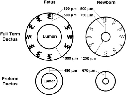 Comparative anatomy of ductus arteriosus vessel wall in fetal, preterm, and term newborns showing structural differences affecting closure