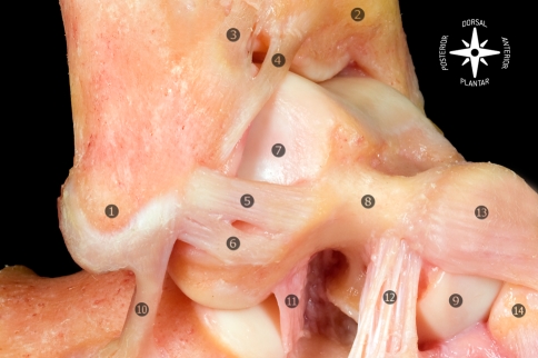 ATFL dual-band anatomic configuration