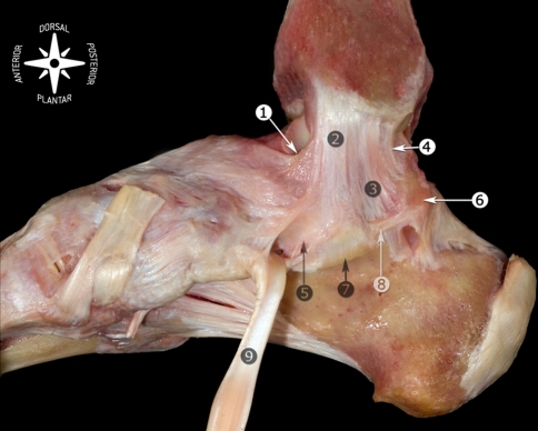 Cadaveric dissection of the medial ankle ligaments