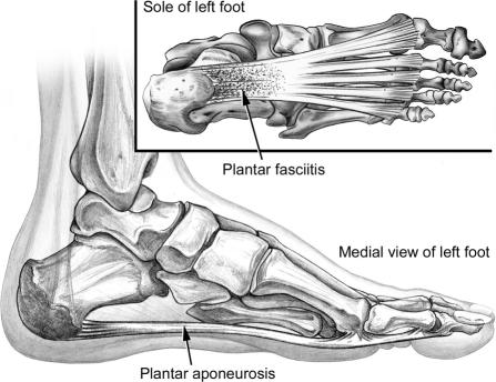 Plantar aponeurosis anatomy from inferior view