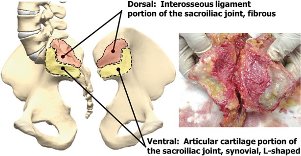 Sacroiliac joint anatomy showing articular surfaces and surrounding ligaments