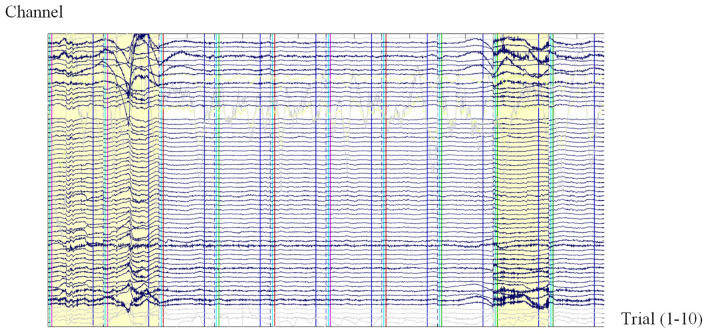 EEG waveform tracings from multiple epochs showing characteristic patterns across different sleep stages including vertex sharp waves, K-complexes, sleep spindles, and slow-wave delta activity
