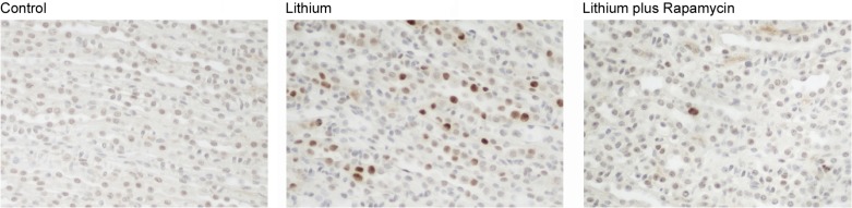 PCNA immunostaining showing increased cell proliferation in collecting ducts of lithium-treated kidneys