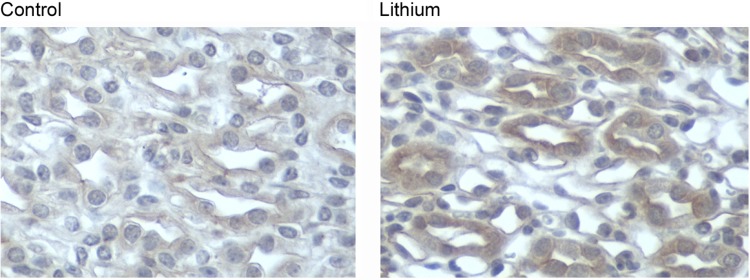 Immunohistochemistry of renal collecting duct showing lithium-induced changes in phospho-mTOR expression and cellular architecture
