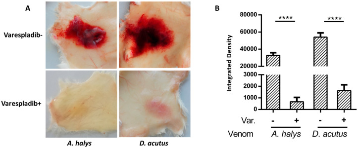 Hemorrhagic effects of crotalid venom showing tissue damage and the protective effects of PLA2 inhibitor treatment