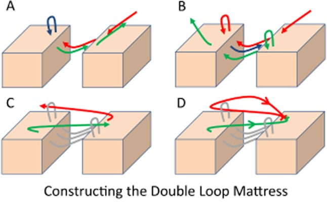 Diagram comparing different suture techniques including simple interrupted, horizontal mattress, and vertical mattress suture configurations for wound closure