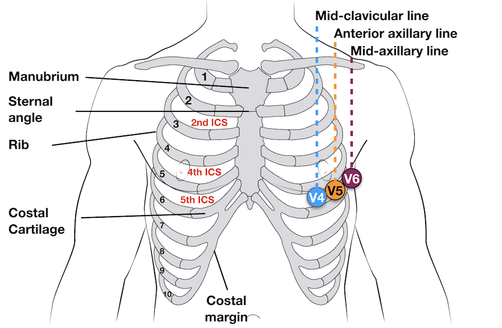 Chest external landmarks for ECG electrode placement showing intercostal spaces and anatomic reference points