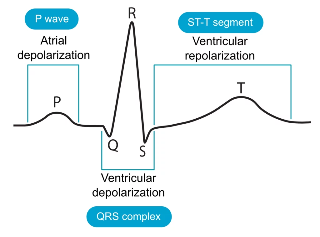 ECG waveform showing P wave, QRS complex, ST segment, and T wave correlated with atrial and ventricular depolarization and repolarization
