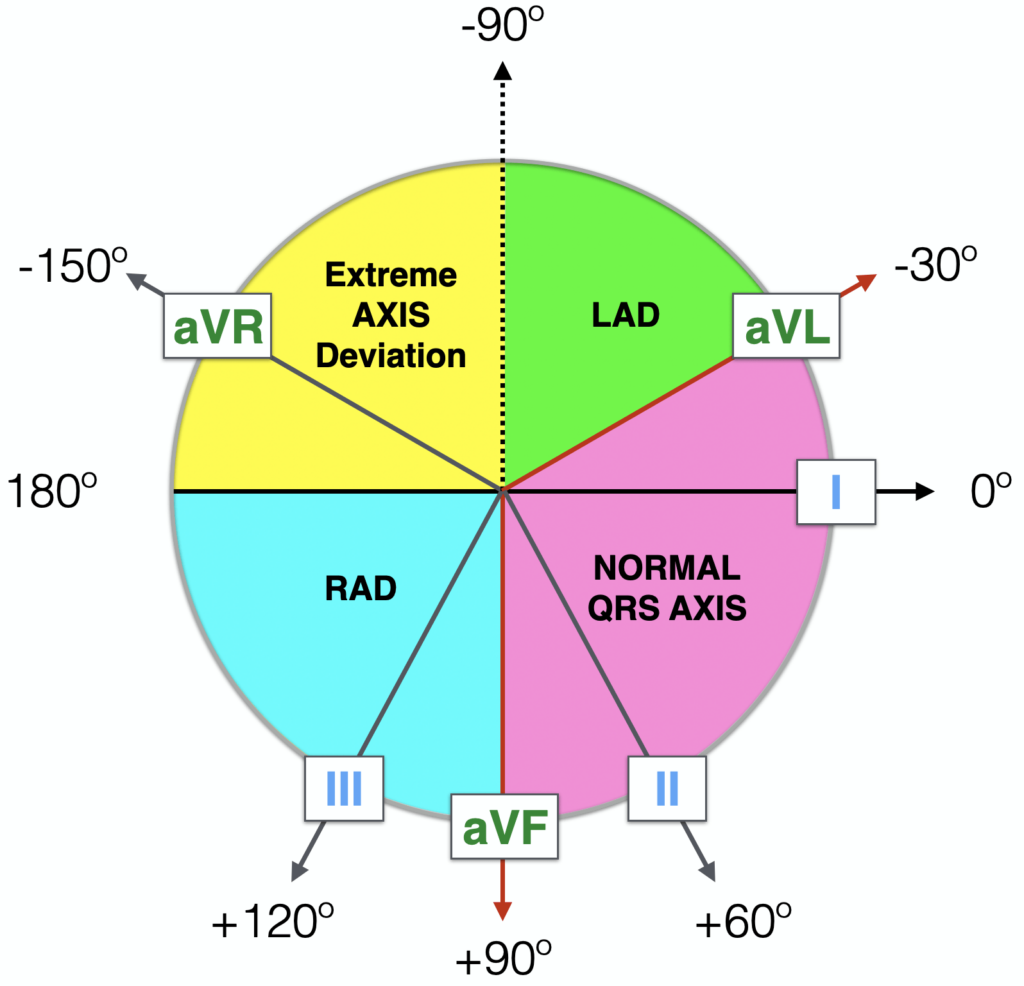 Hexaxial reference system showing the six frontal plane leads and their angles for ECG axis determination