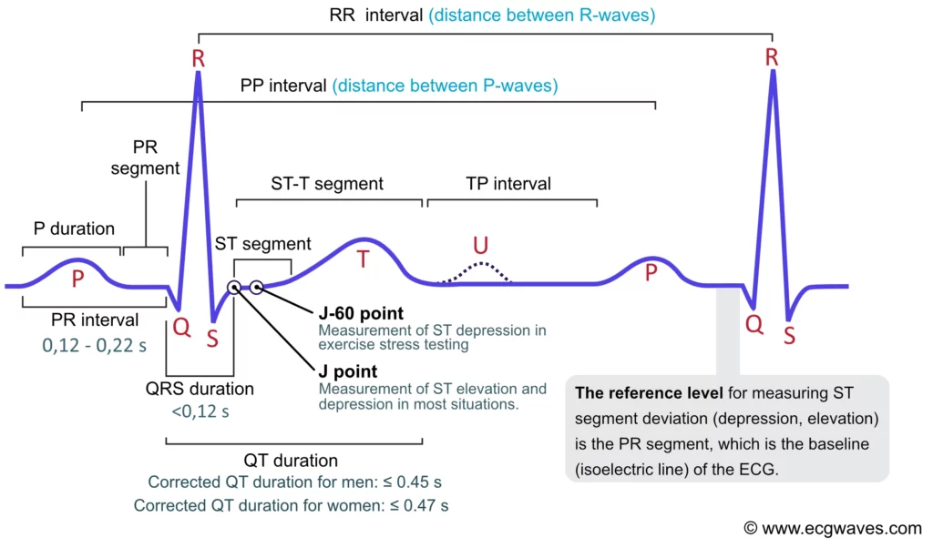 Labeled ECG waveform showing P wave, QRS complex, ST segment, T wave, PR interval, QT interval, and J point
