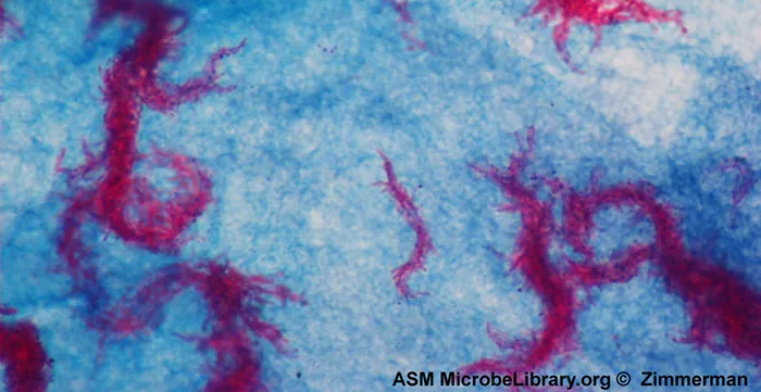 Acid-fast staining showing bright red Mycobacterium tuberculosis organisms against a blue background