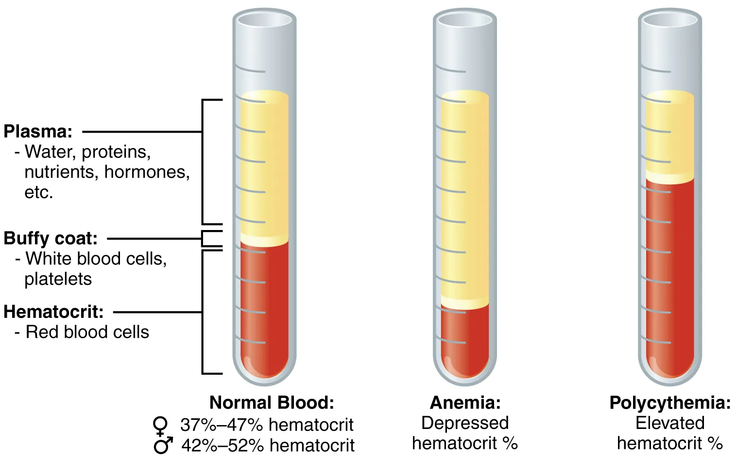 Three test tubes showing normal blood, anemic blood, and polycythemic blood separated into plasma and cellular components