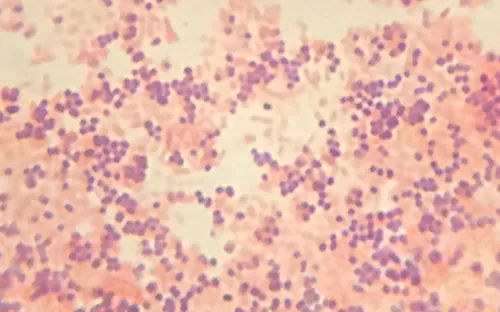 Comparison micrographs of gram-positive bacteria (purple) and gram-negative bacteria (pink) under microscopy