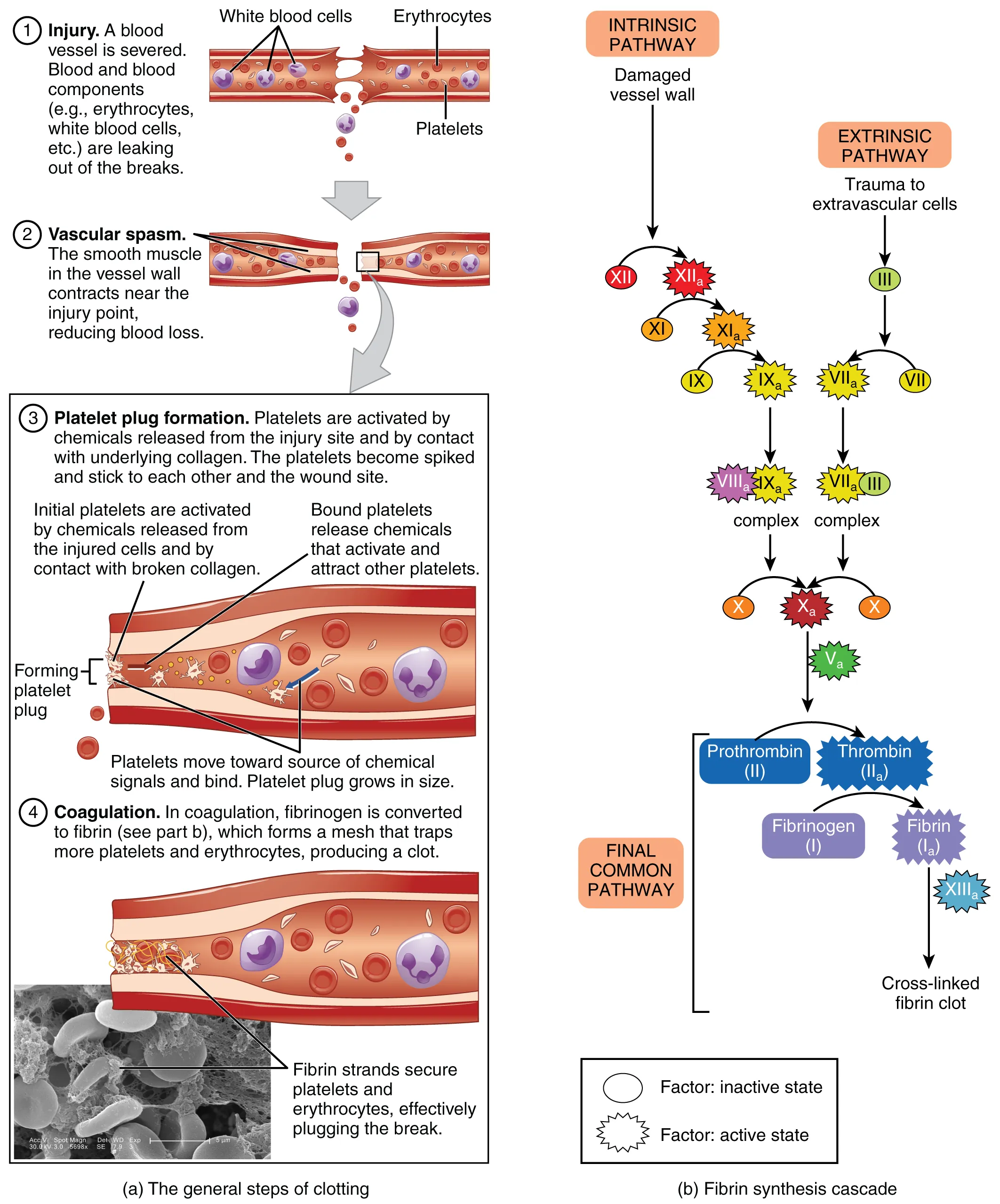 Three-step hemostasis diagram showing vascular spasm, platelet plug formation, and the coagulation cascade with intrinsic and extrinsic pathways