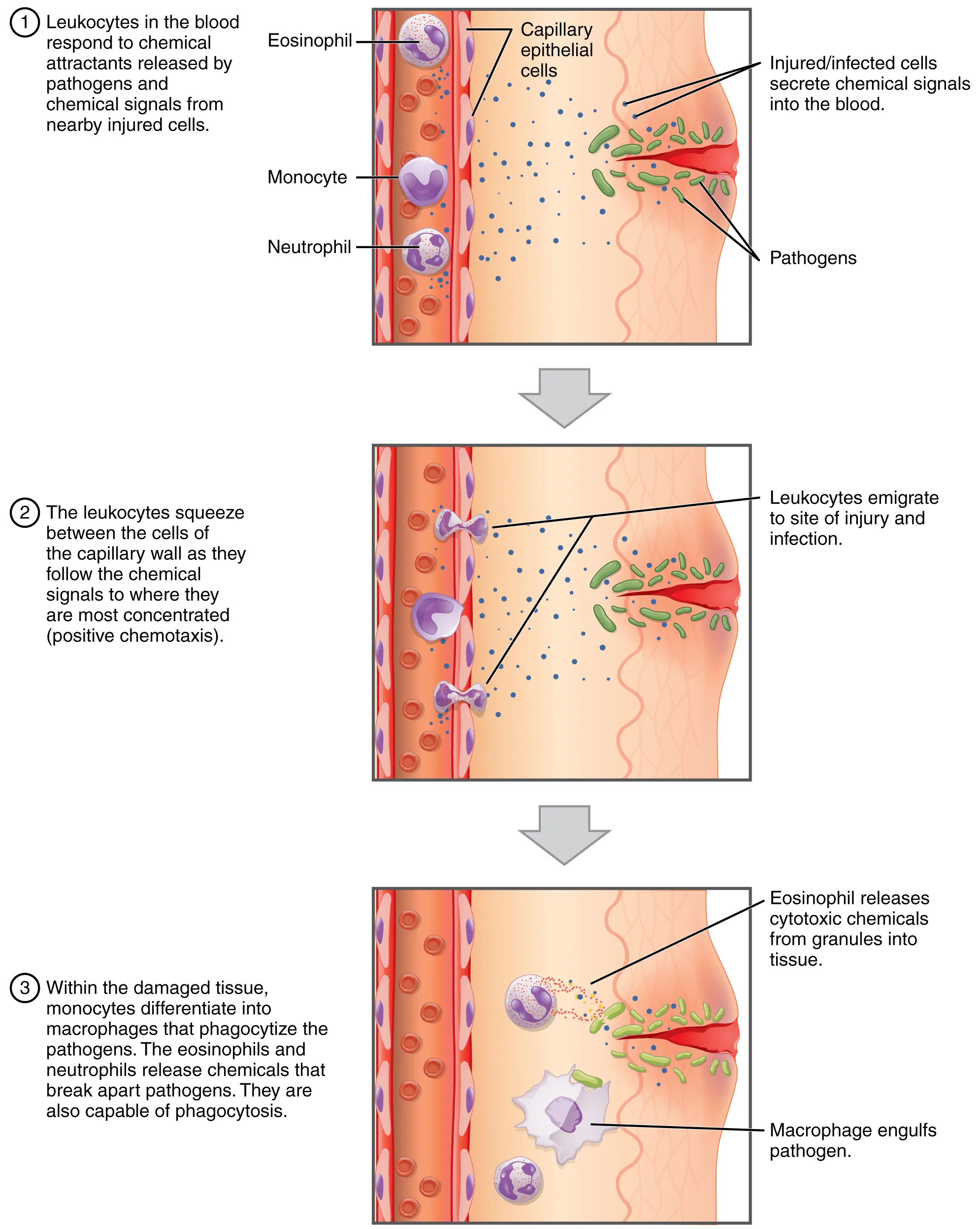 Diagram showing leukocyte emigration through blood vessel walls during the inflammatory response