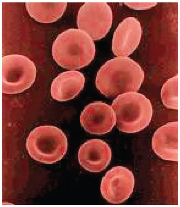 Scanning electron micrograph of normal biconcave erythrocytes showing their characteristic discoid shape