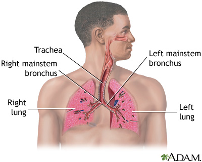Respiratory system showing trachea, bronchi, lungs, and diaphragm