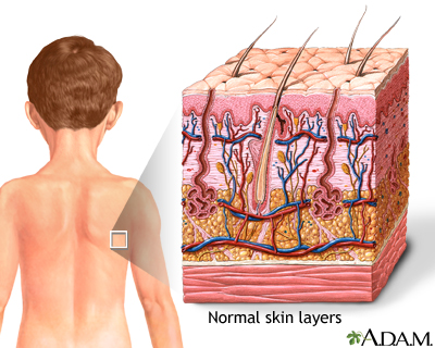 Detailed skin anatomy showing epidermis, dermis, subcutaneous tissue, hair follicles, and glands
