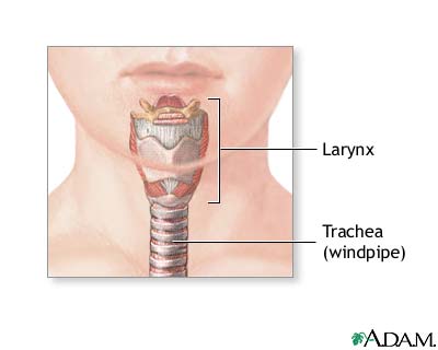 Tracheostomy tube placement in the anterior trachea