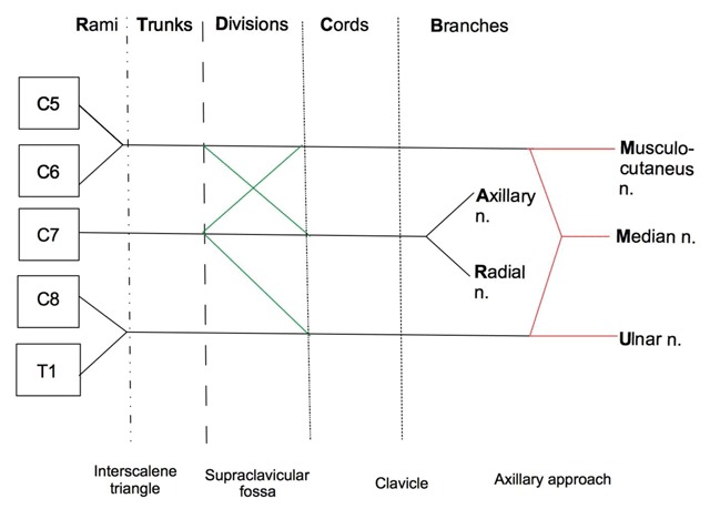 Brachial plexus block approaches showing sonoanatomy and needle placement for interscalene, supraclavicular, infraclavicular, and axillary approaches