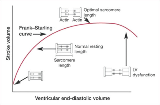 Frank-Starling curve showing the relationship between preload and stroke volume, with shifts for heart failure and inotrope use