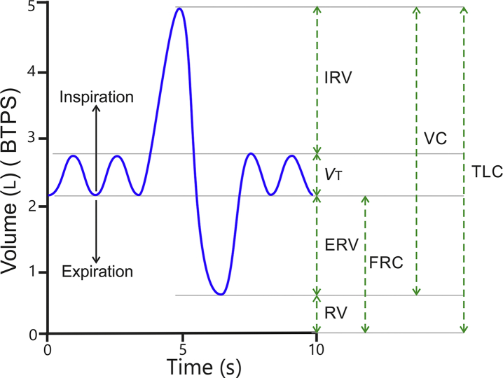 Diagram of standard lung volumes and capacities including tidal volume, IRV, ERV, residual volume, FRC, vital capacity, and total lung capacity