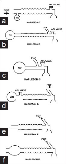 Mapleson breathing circuits A through F showing different arrangements of fresh gas flow, reservoir bag, and APL valve