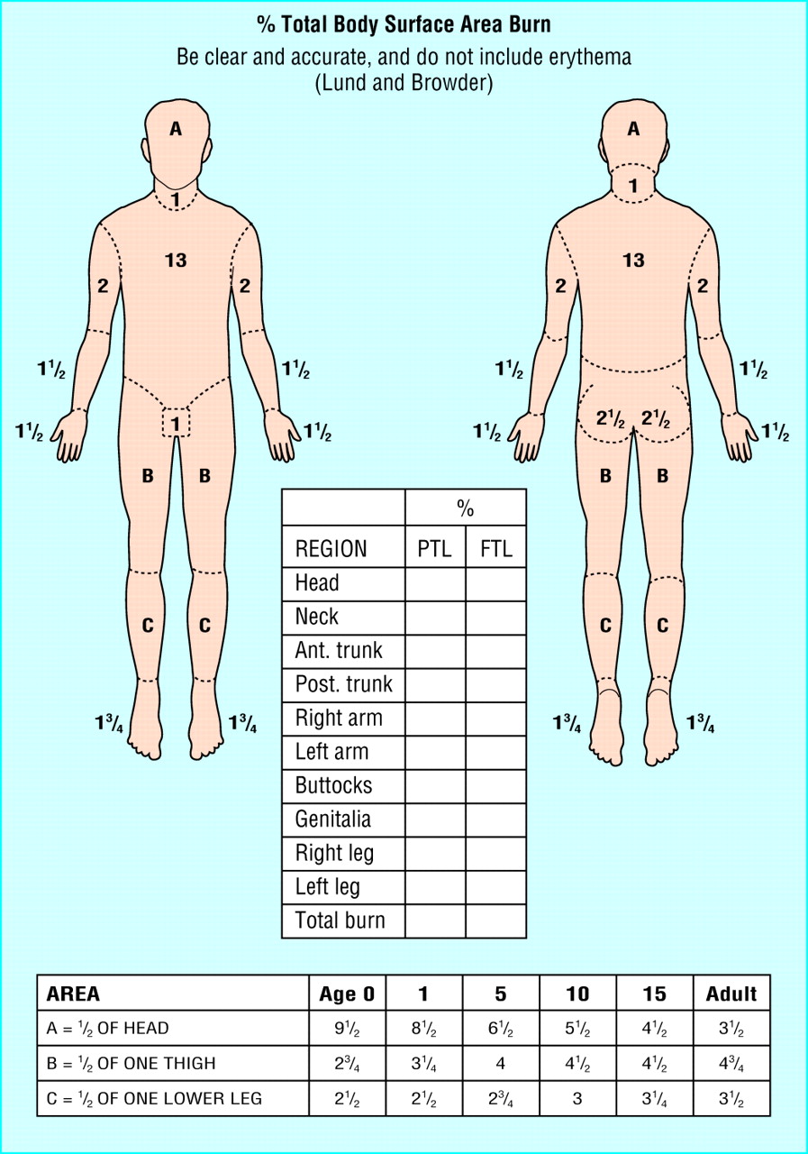 Lund and Browder chart for precise burn surface area assessment with age-adjusted percentages for different body regions