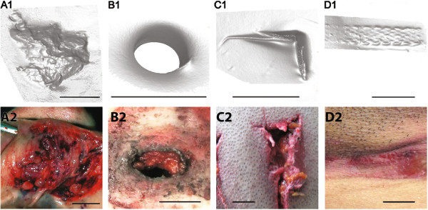 Comparison of plasticine models of skin injuries with actual wound types including abrasions, gunshot entry wounds, patterned lacerations, and strangulation marks