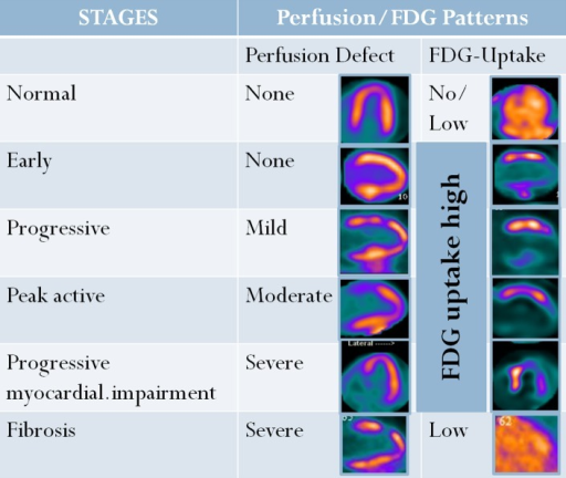 FDG PET and perfusion imaging showing perfusion-metabolism mismatch patterns in cardiac viability assessment