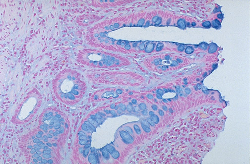 Alcian blue stain showing blue-stained mucin in goblet cells of intestinal epithelium