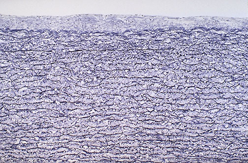 Van Gieson elastic stain of aorta showing parallel dark elastic fibers in the media