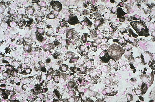 Fontana-Masson stain showing black melanin granules in melanocytic cells of skin