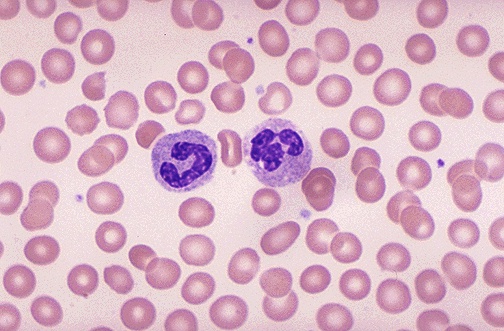 Normal peripheral blood smear with Wright stain showing red blood cells and white blood cells