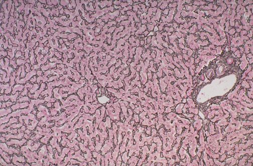 Reticulin stain of normal liver showing black reticular fiber network around hepatic plates