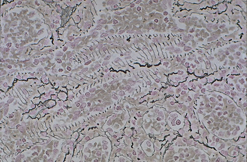 Reticulin stain of normal spleen showing delicate reticular fiber network at high magnification