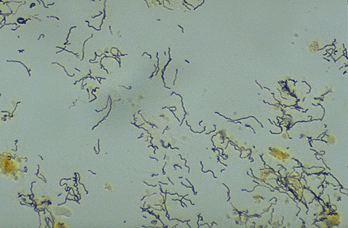 Warthin-Starry silver stain showing dark spirochete organisms against yellow background
