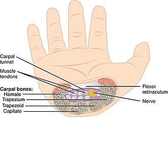Cross-sectional view of the carpal tunnel showing the median nerve, flexor tendons, and flexor retinaculum