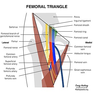 Diagram of the femoral triangle showing boundaries and contents: NAVEL - nerve, artery, vein, empty space, lymphatics