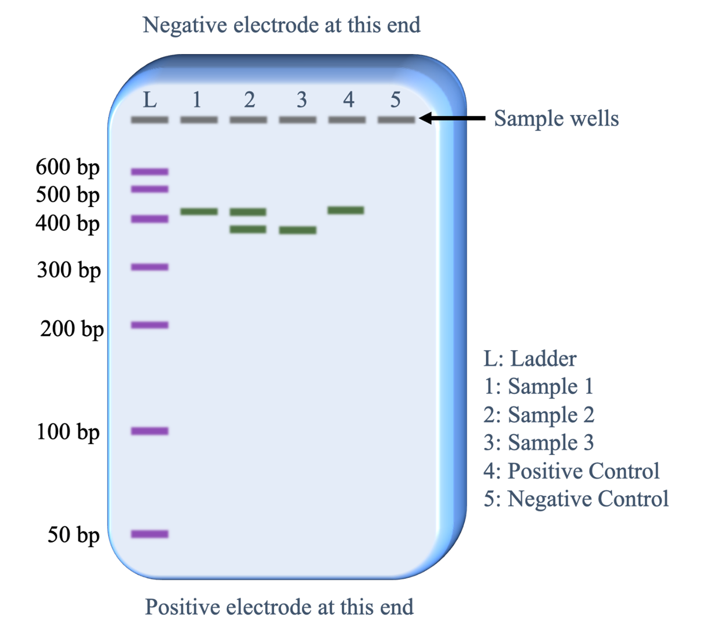 Gel electrophoresis showing DNA fragments separated by size with molecular weight ladder