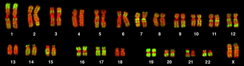 Normal female human karyotype showing 22 pairs of autosomes and XX sex chromosomes arranged by size